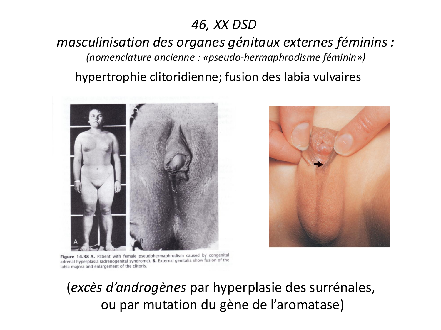 Malformations congénitales page 80