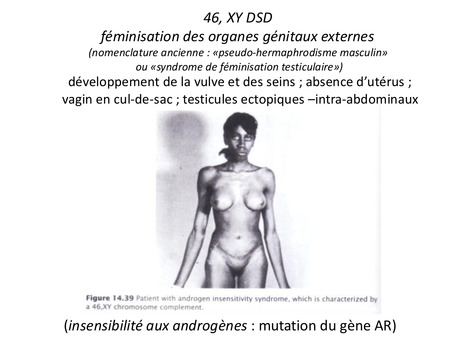 Malformations congénitales page 81