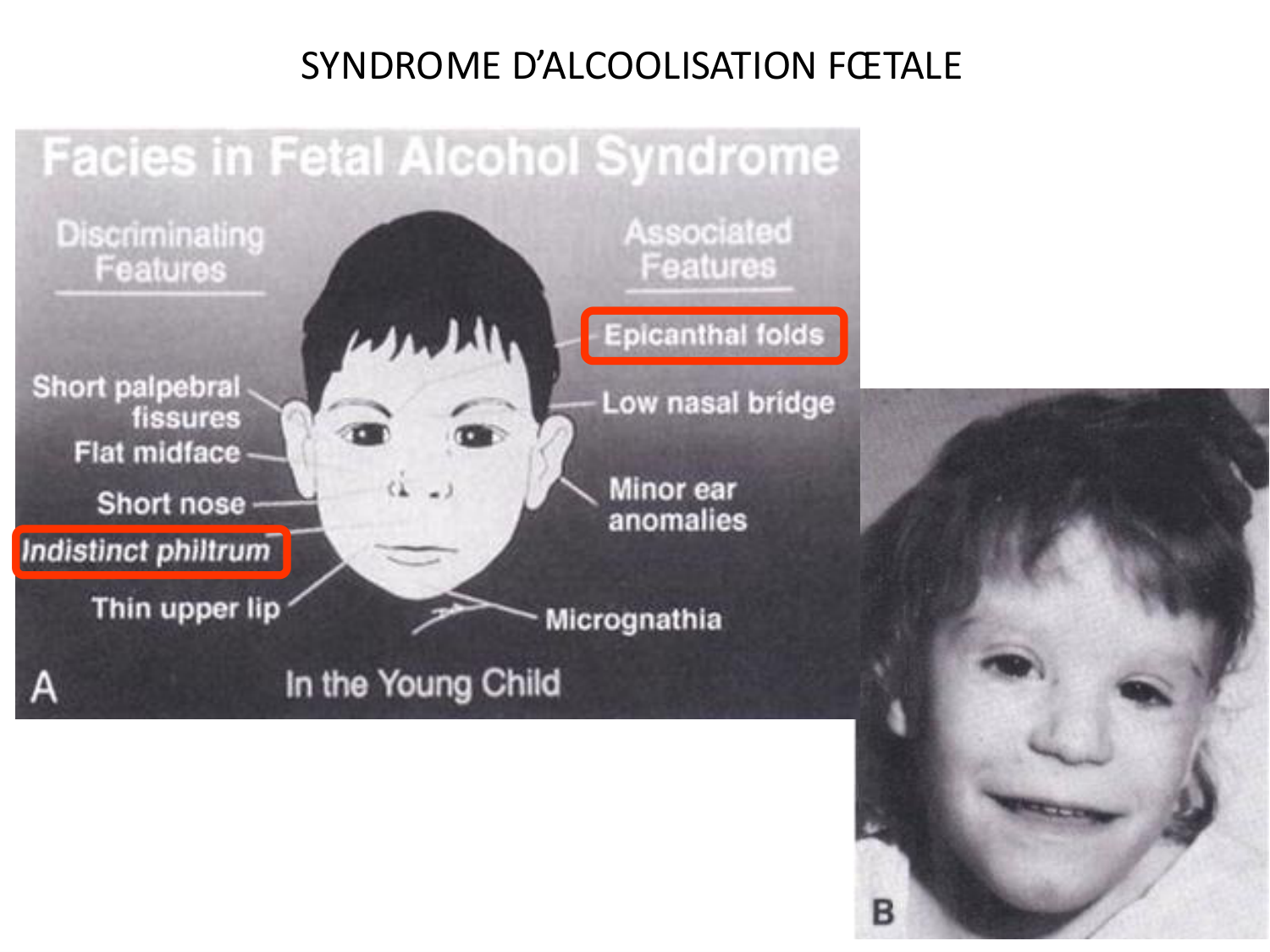 Malformations congénitales page 88