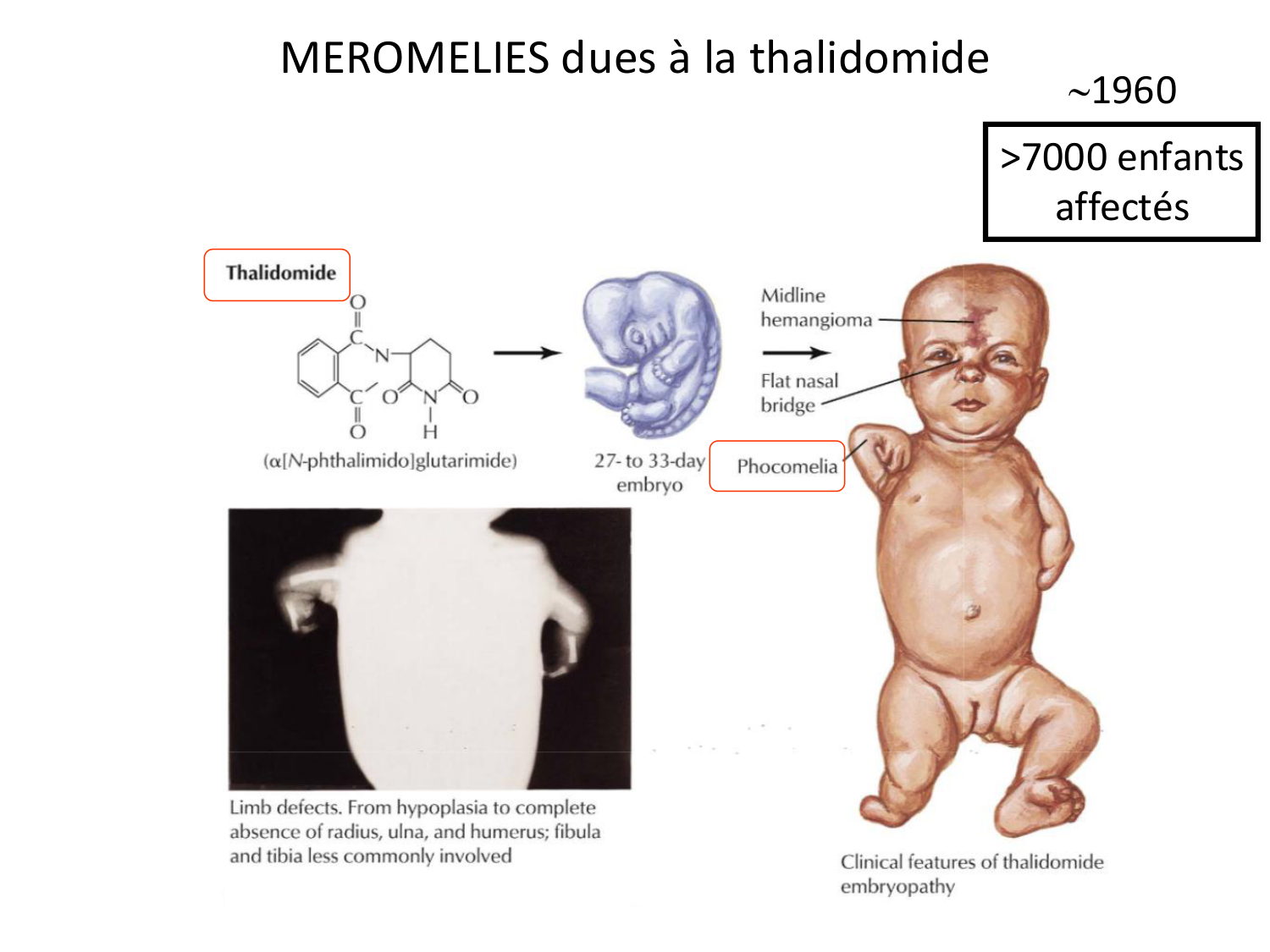 Malformations congénitales page 89