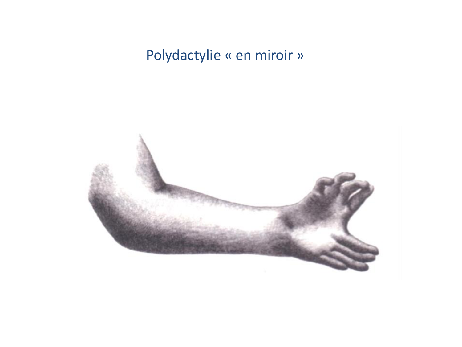 Développement des membres page 19