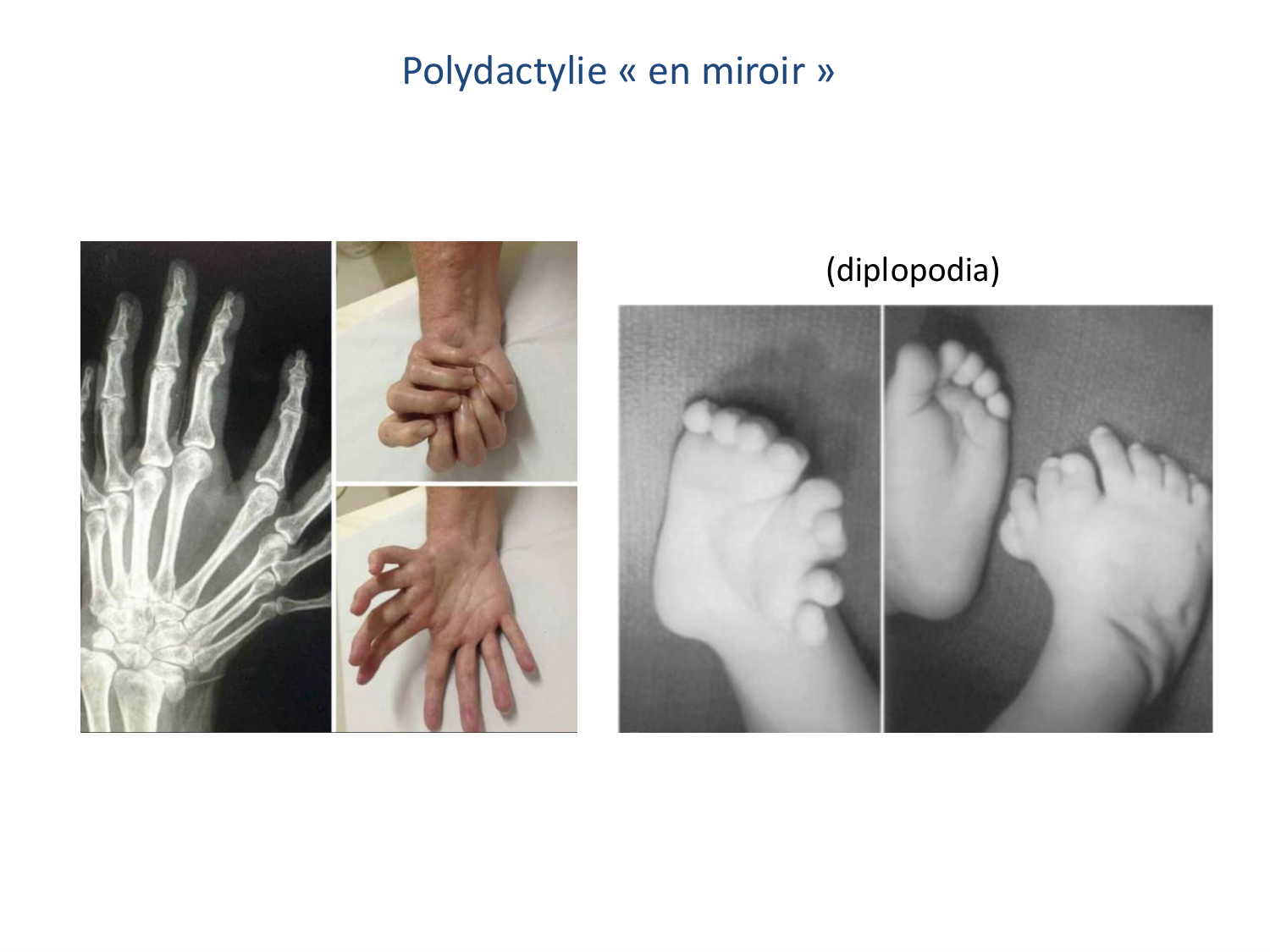 Développement des membres page 20