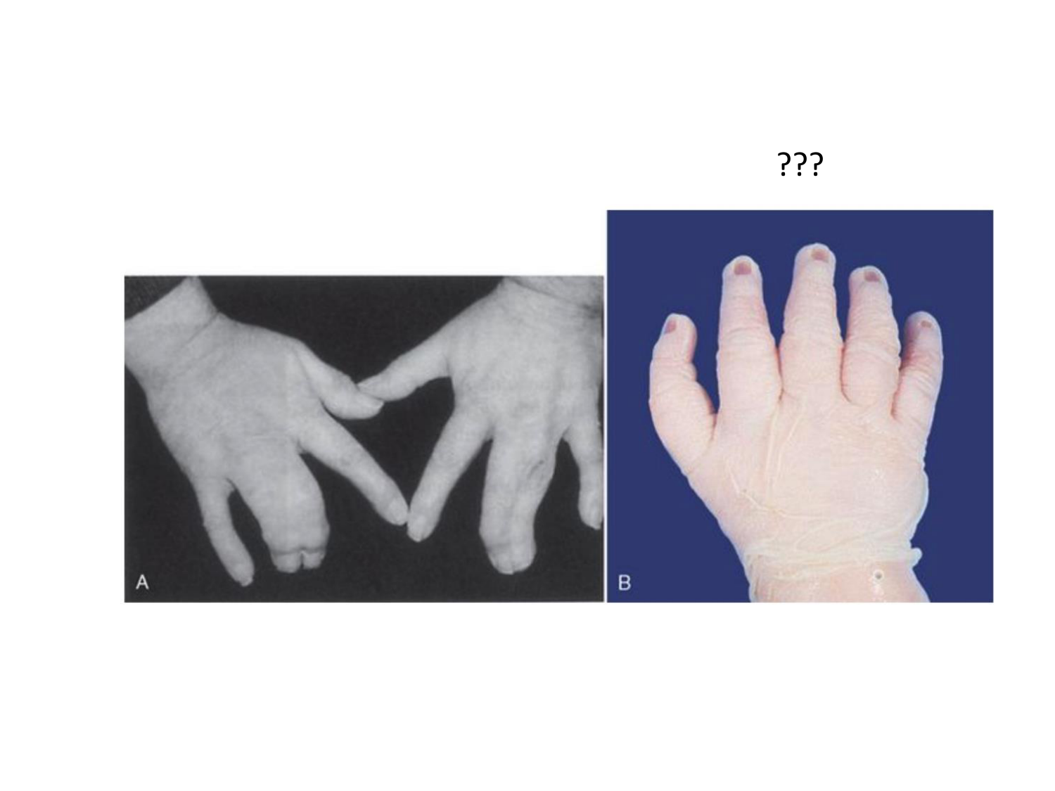 Développement des membres page 30