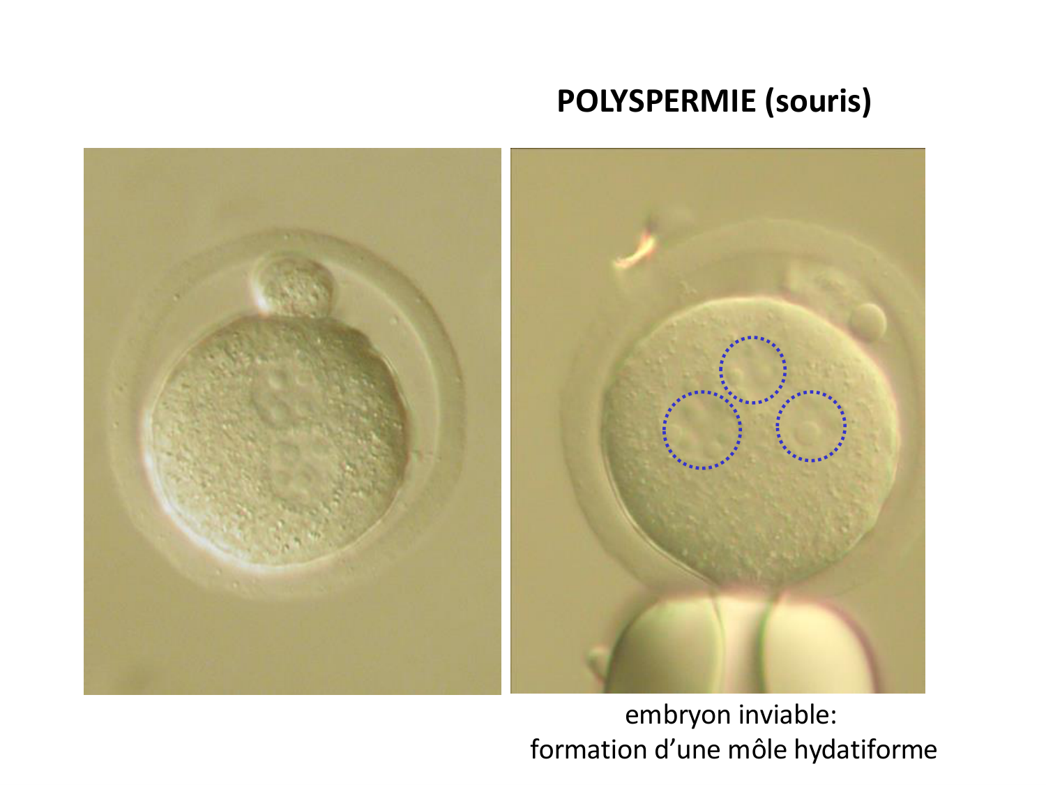 Fécondation et empreinte génomique page 41