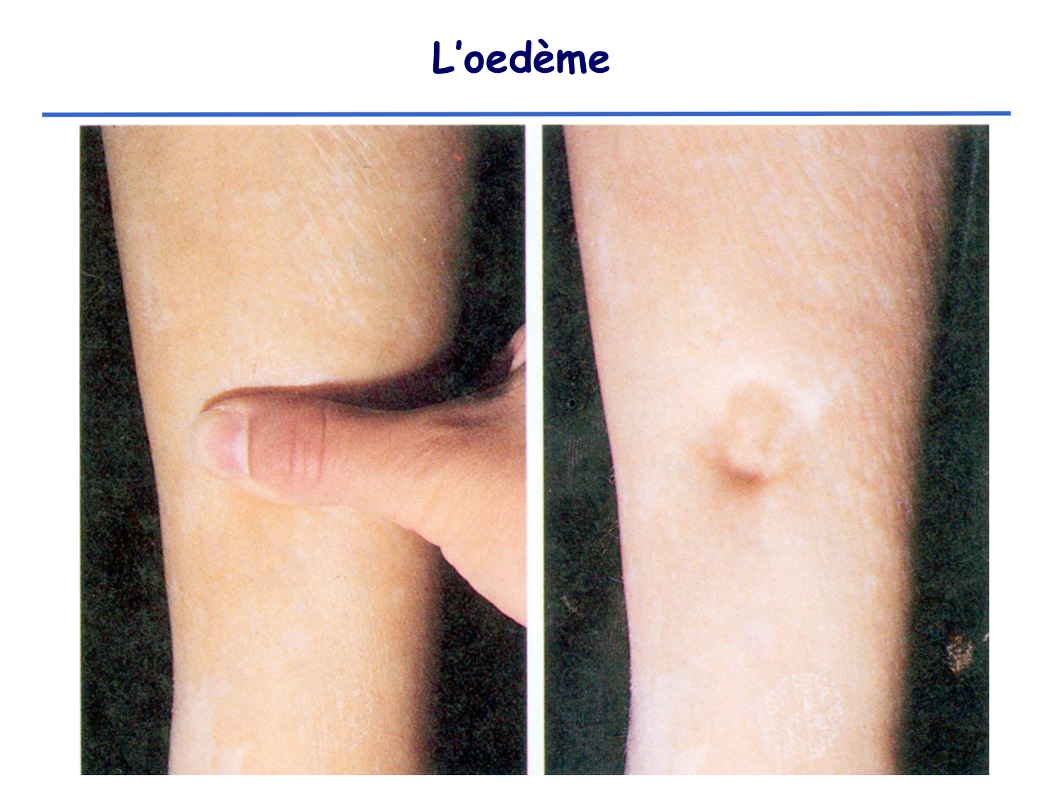 Physiologie cardiovasculaire II page 27