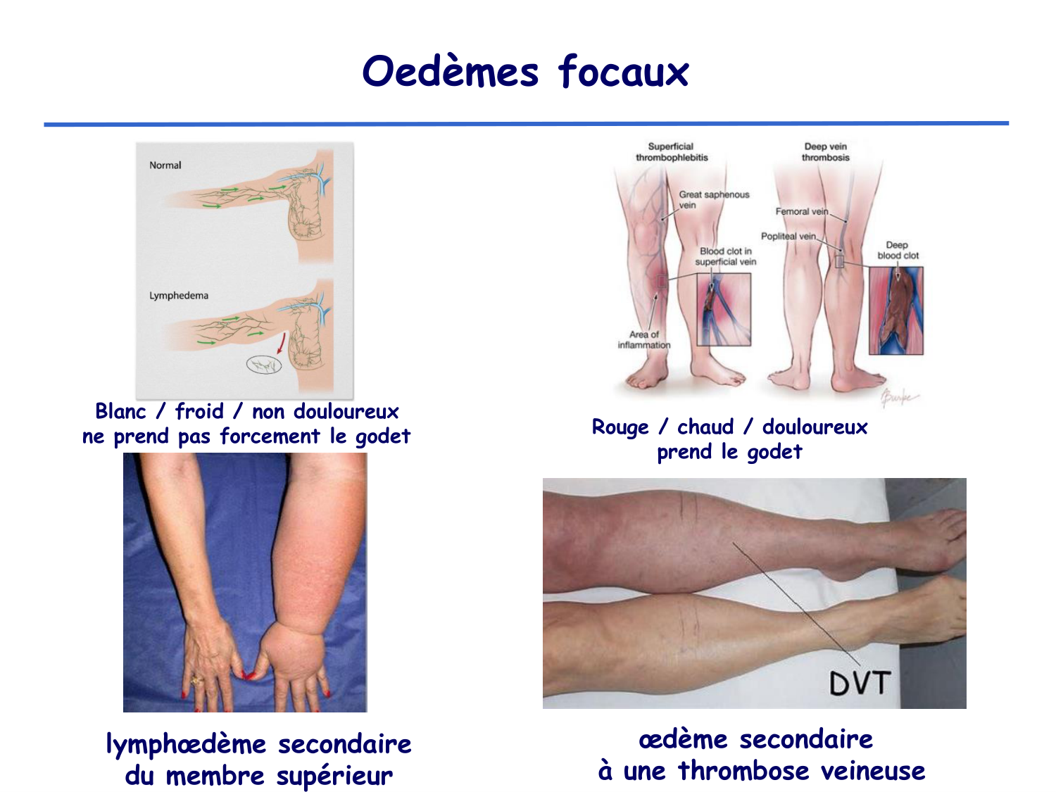 Physiologie cardiovasculaire II page 45