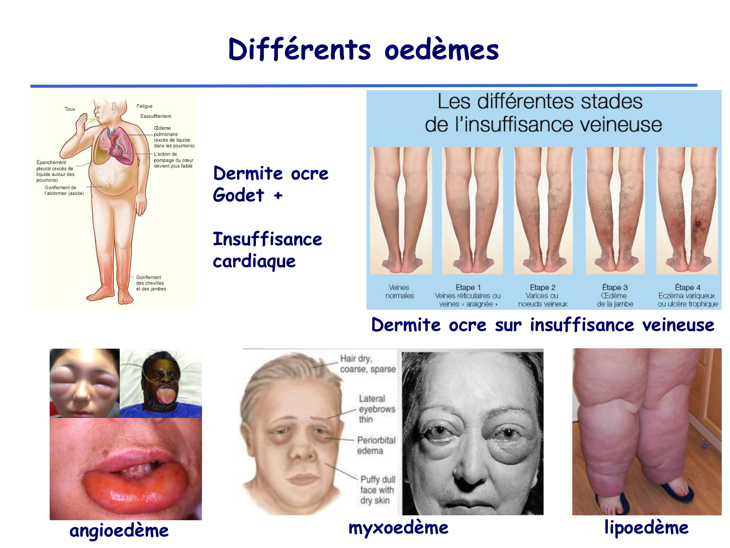 Physiologie cardiovasculaire II page 46