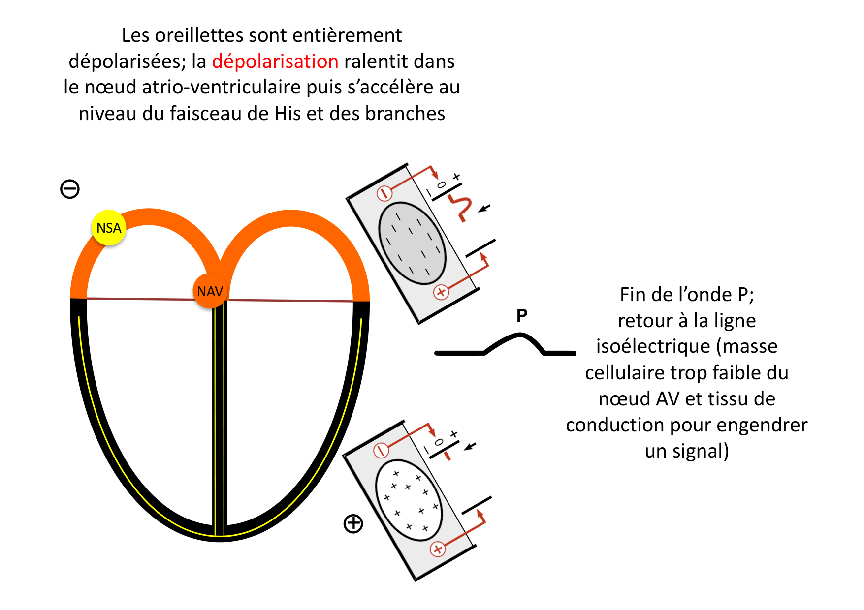 ECG — bases page 14