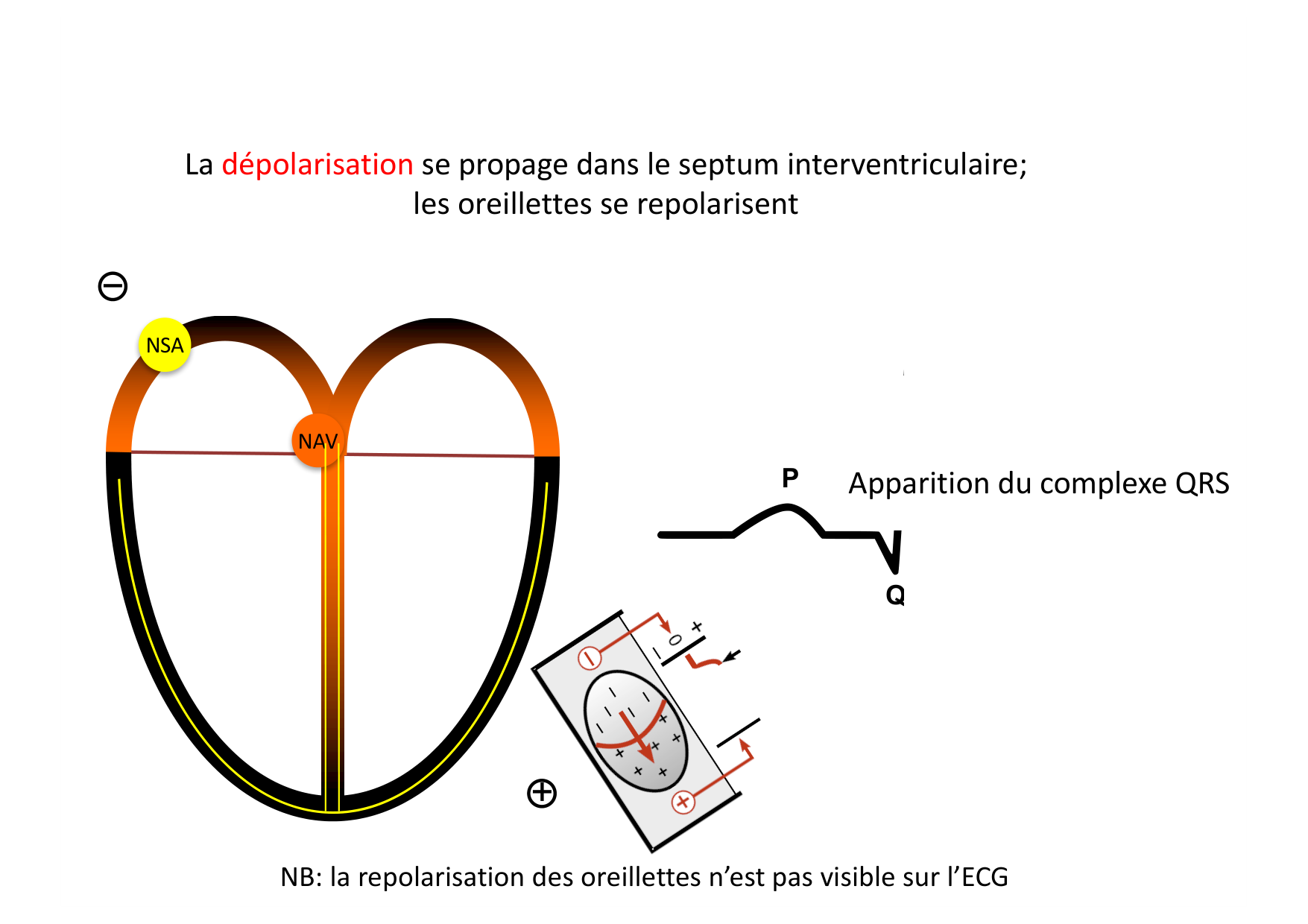 ECG — bases page 16