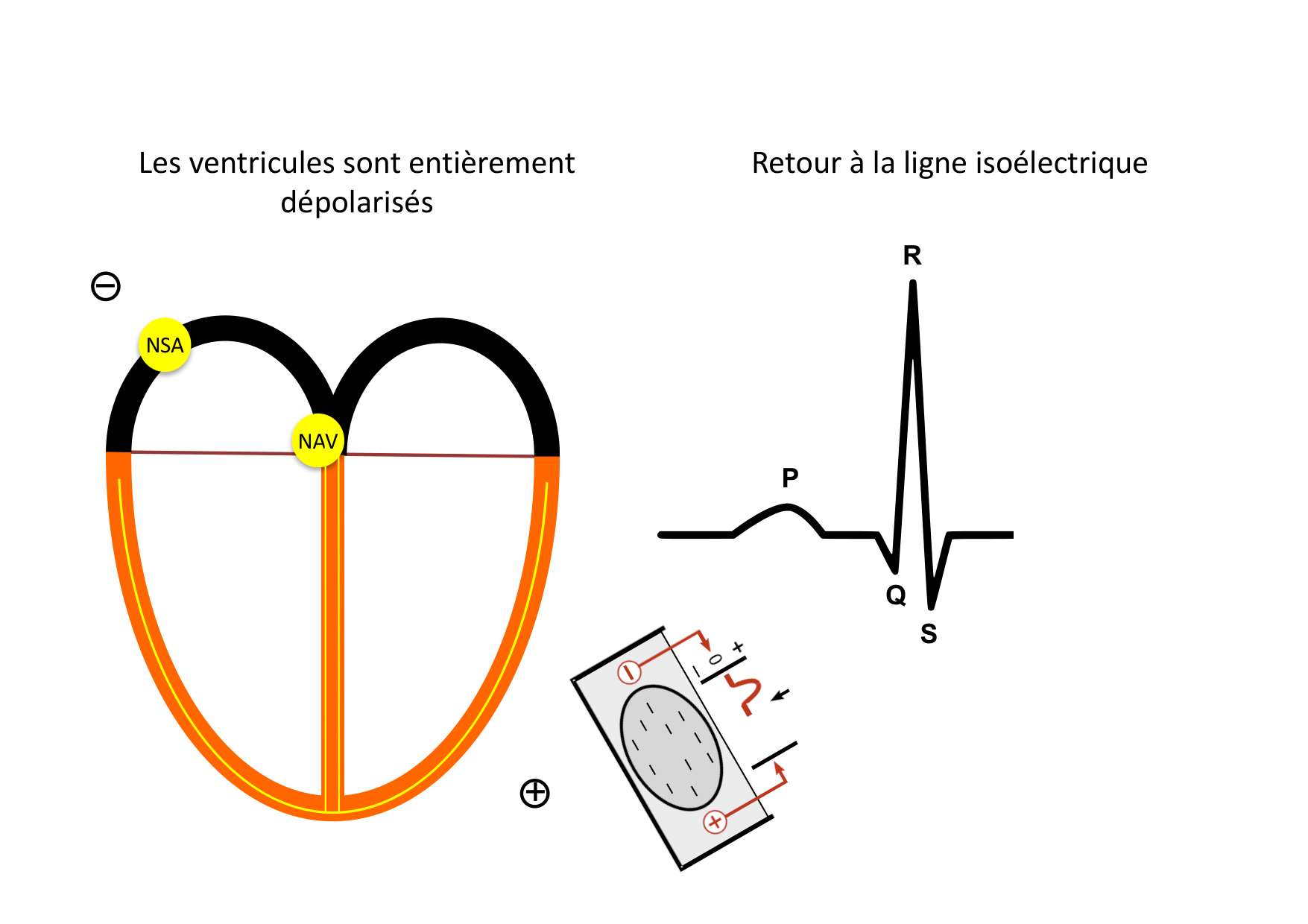 ECG — bases page 18