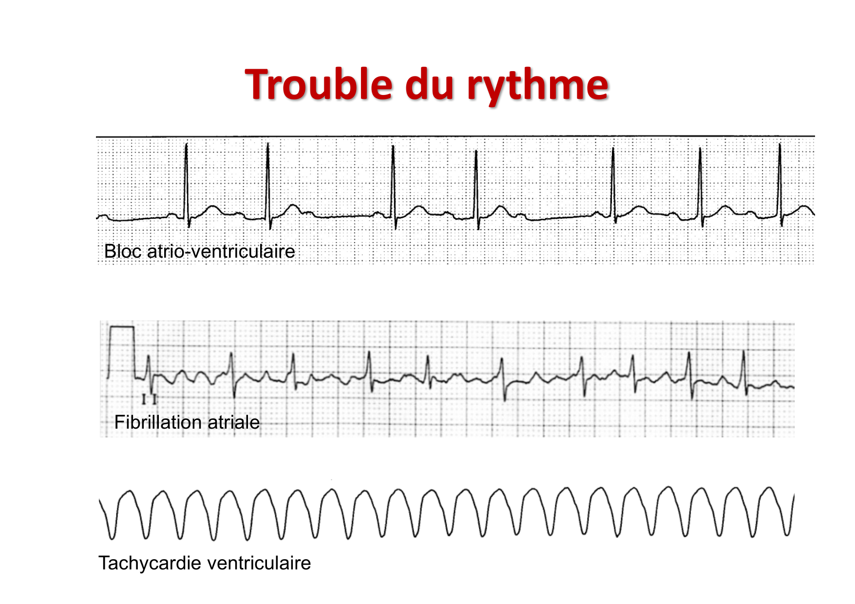 ECG — bases page 23