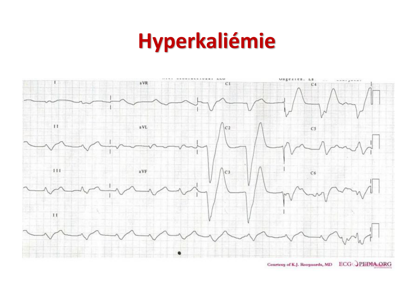 ECG — bases page 25