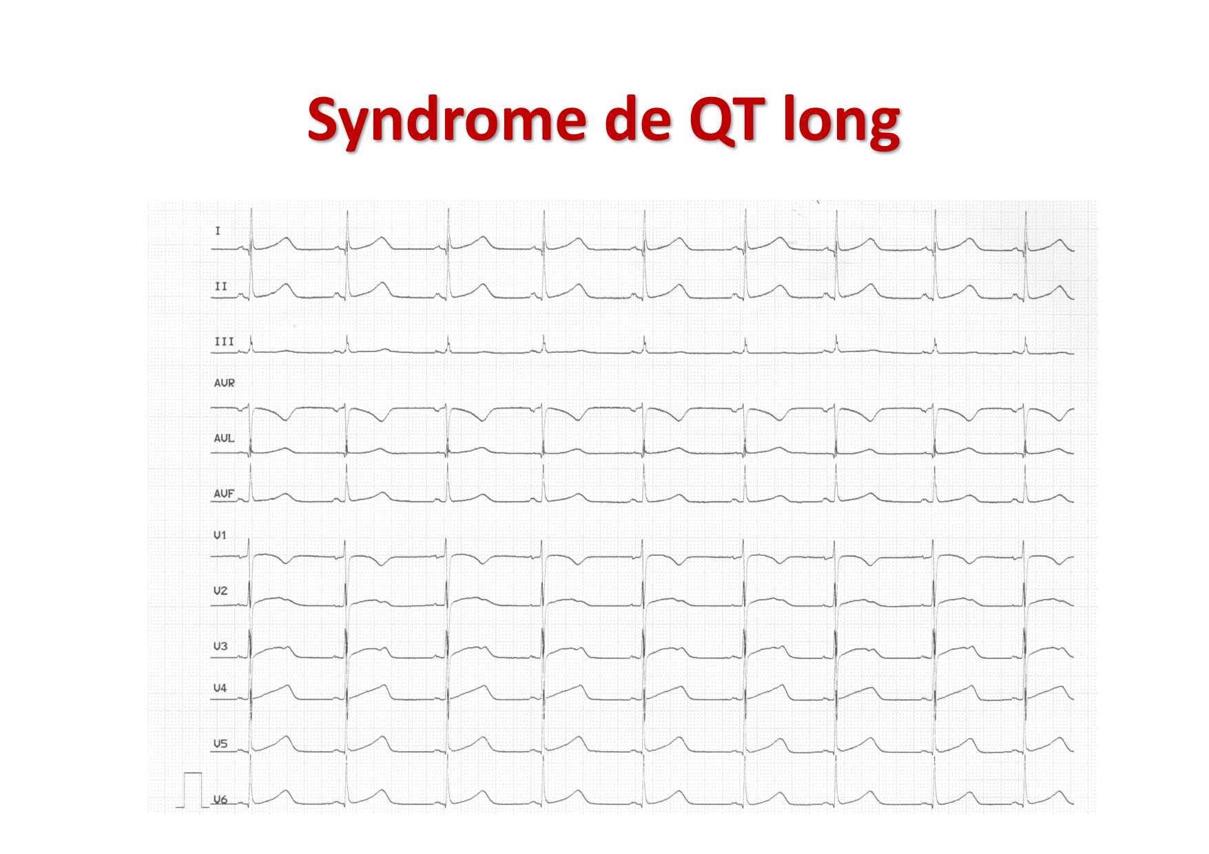 ECG — bases page 26
