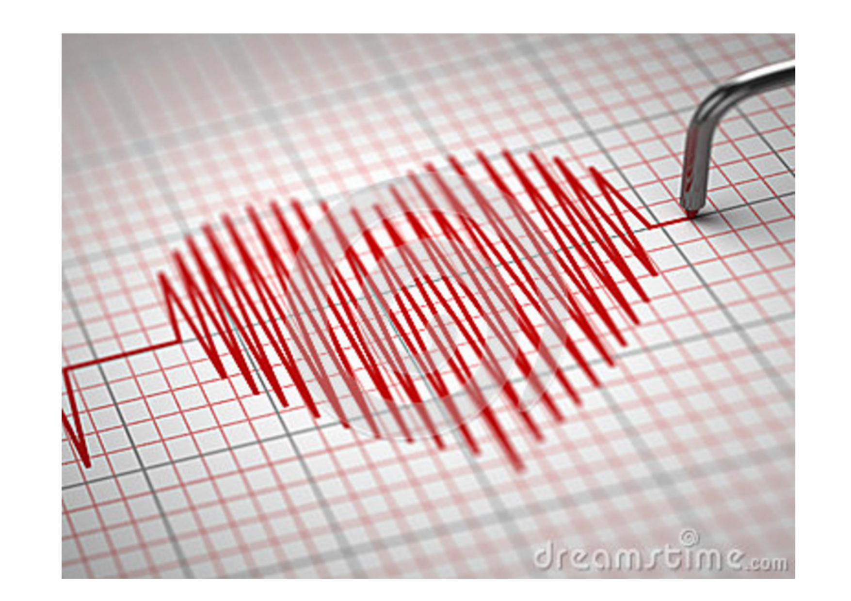 ECG — bases page 27