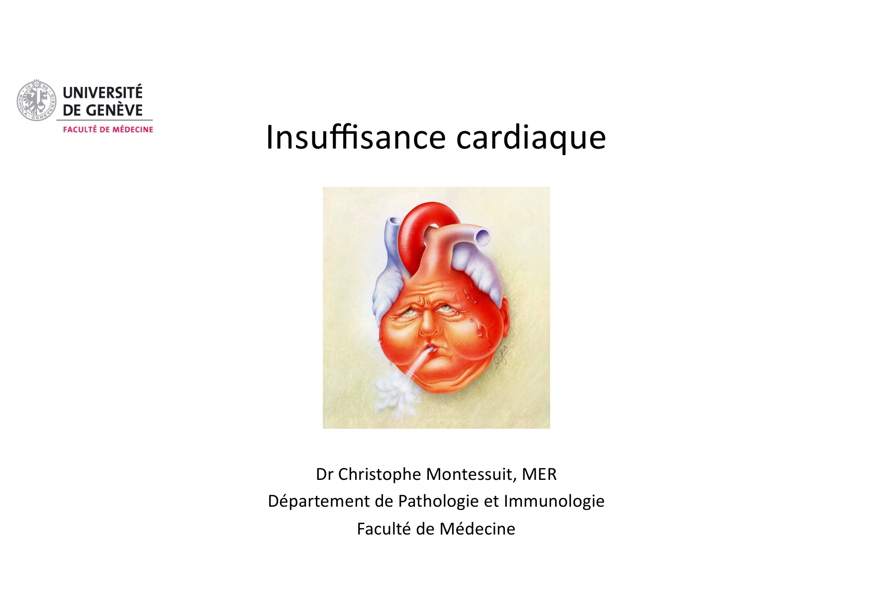 Insuffisance cardiaque page 1