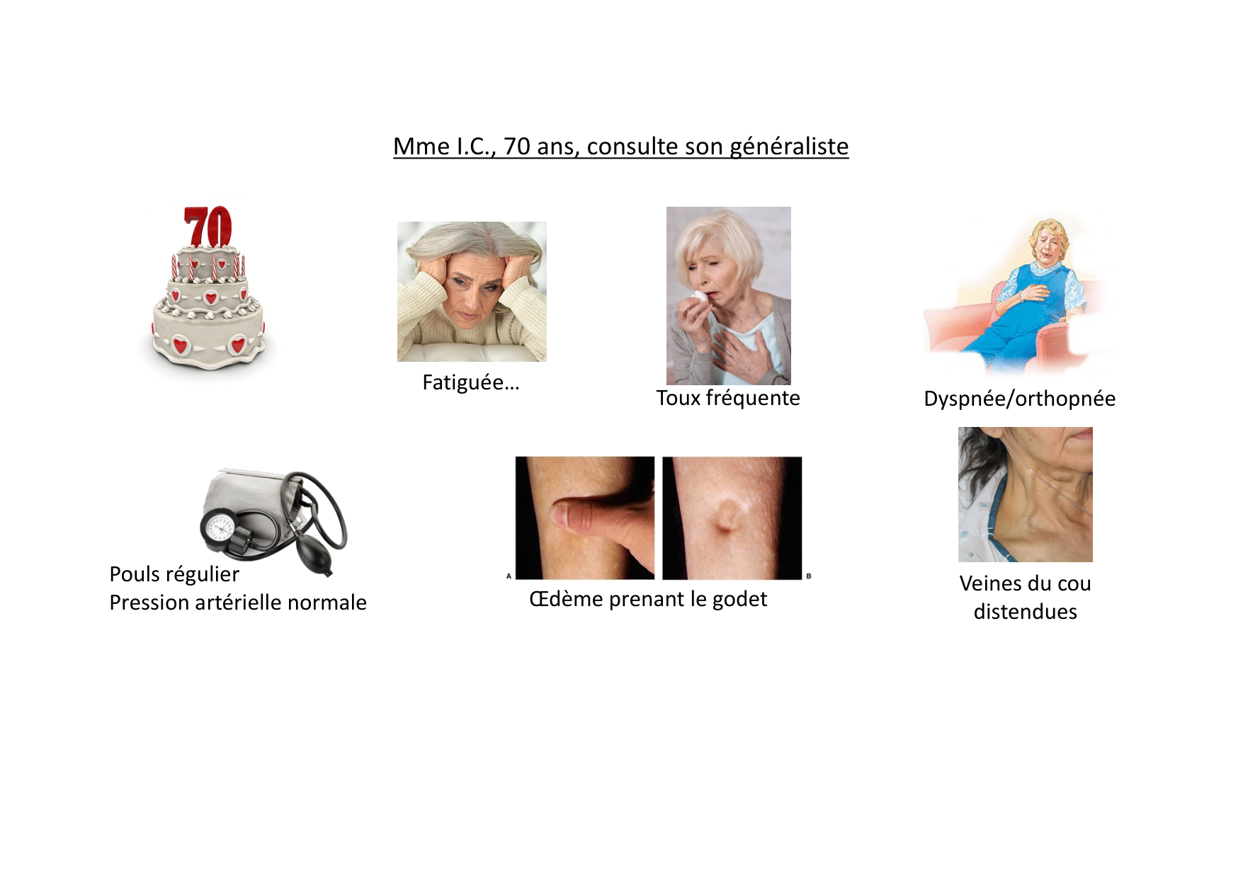 Insuffisance cardiaque page 3