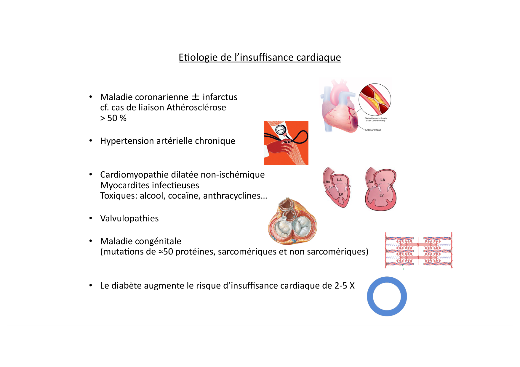 Insuffisance cardiaque page 5