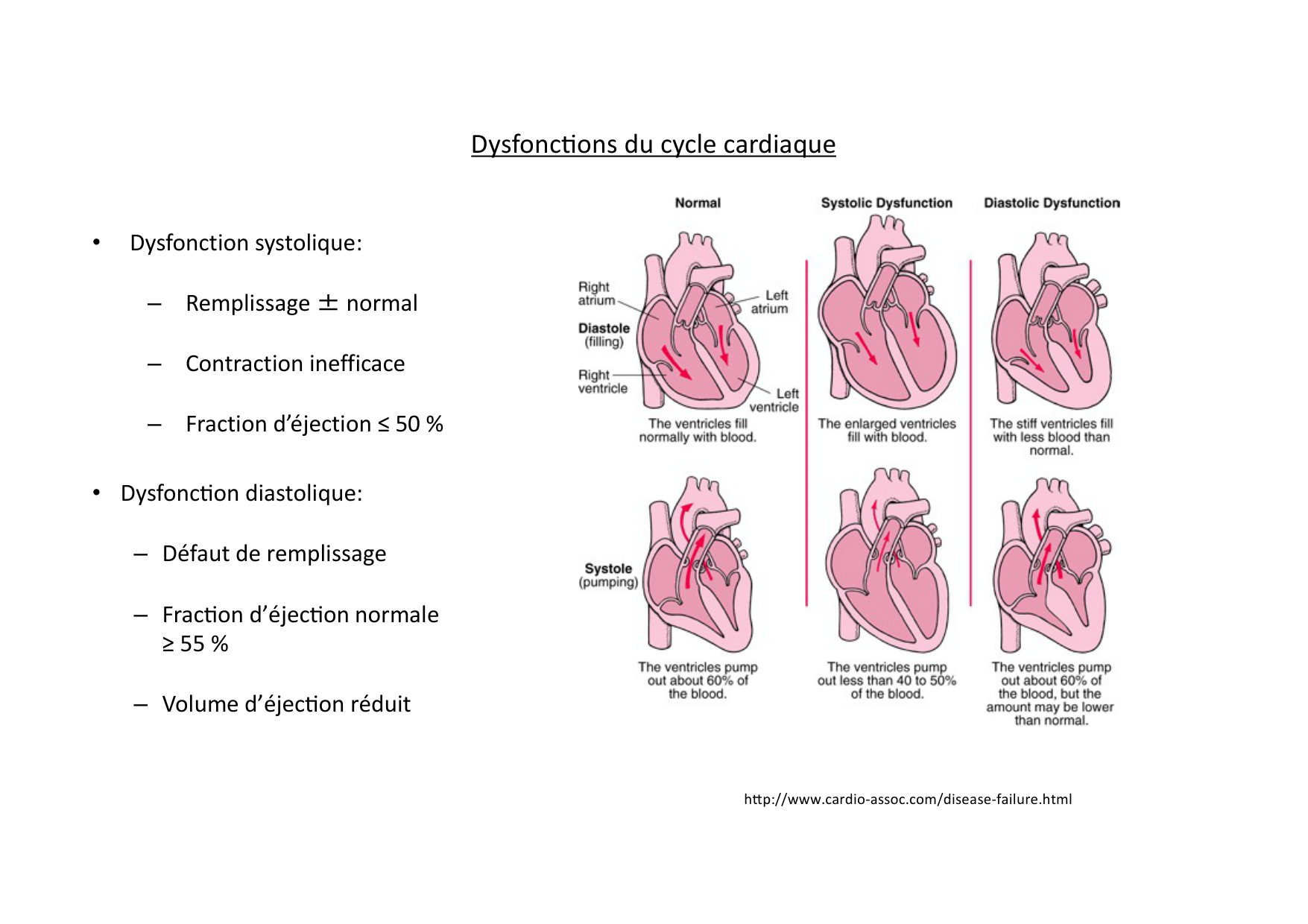 Insuffisance cardiaque page 6