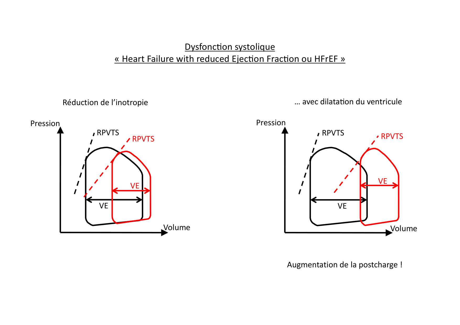 Insuffisance cardiaque page 8