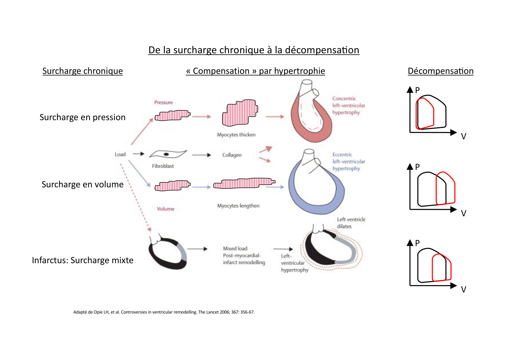 Insuffisance cardiaque page 14