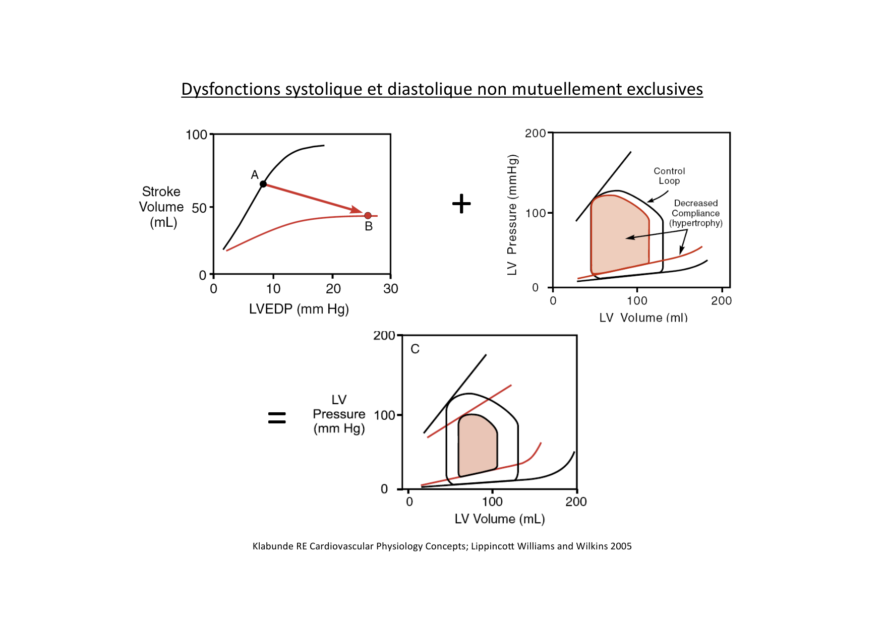 Insuffisance cardiaque page 17