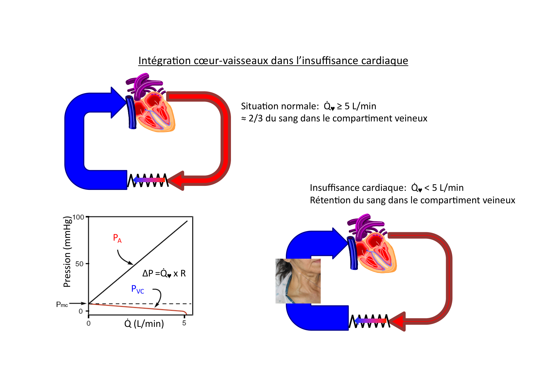 Insuffisance cardiaque page 19