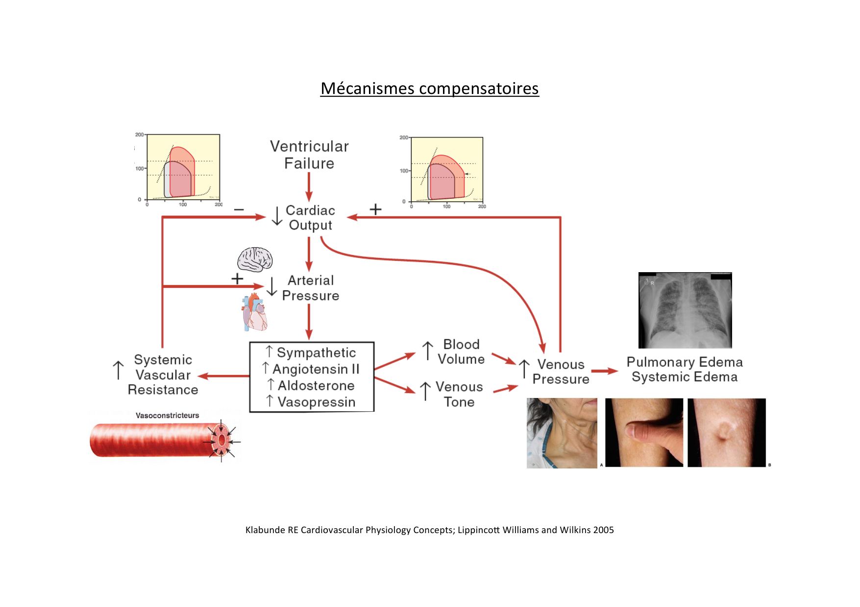 Insuffisance cardiaque page 26