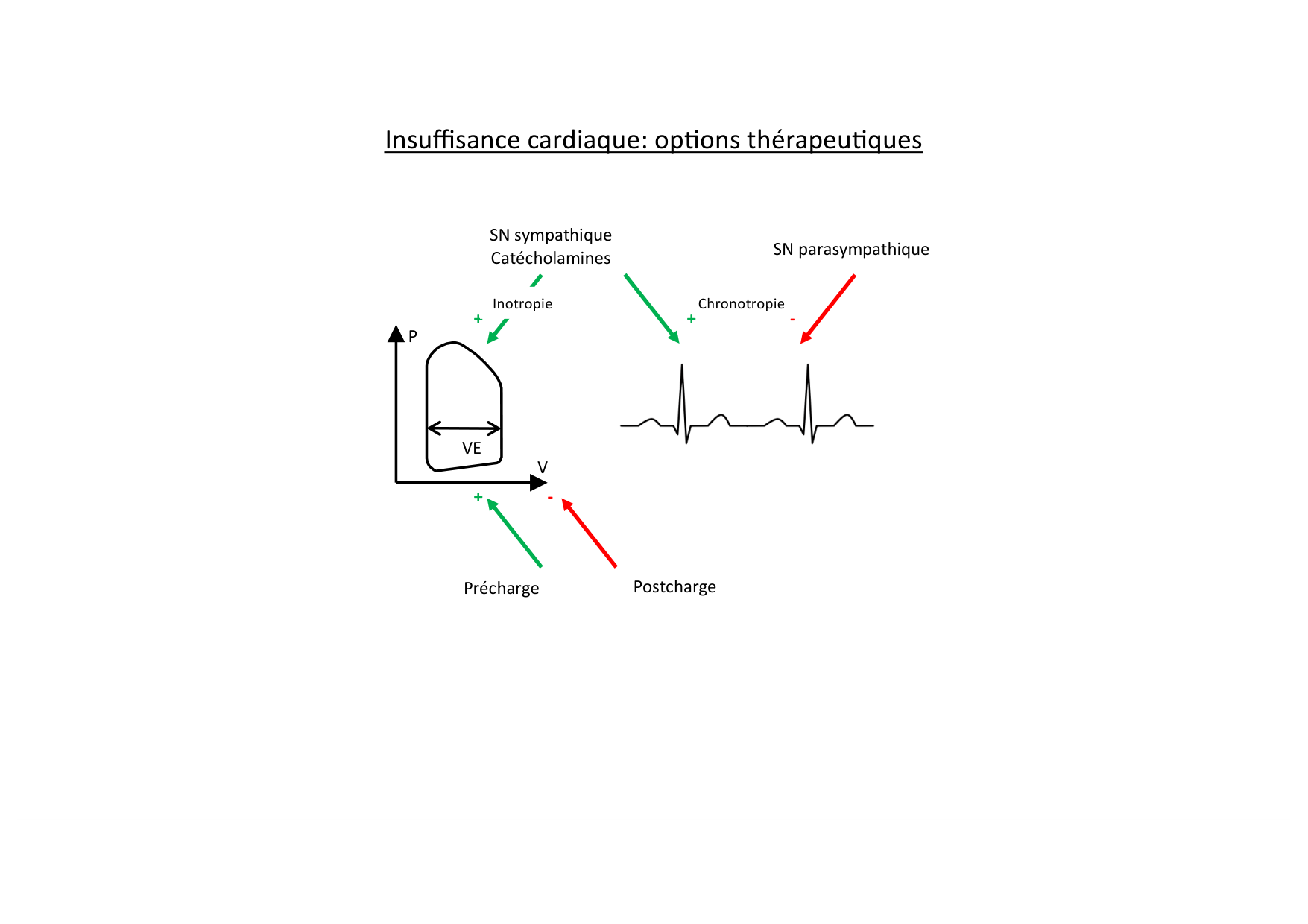 Insuffisance cardiaque page 28
