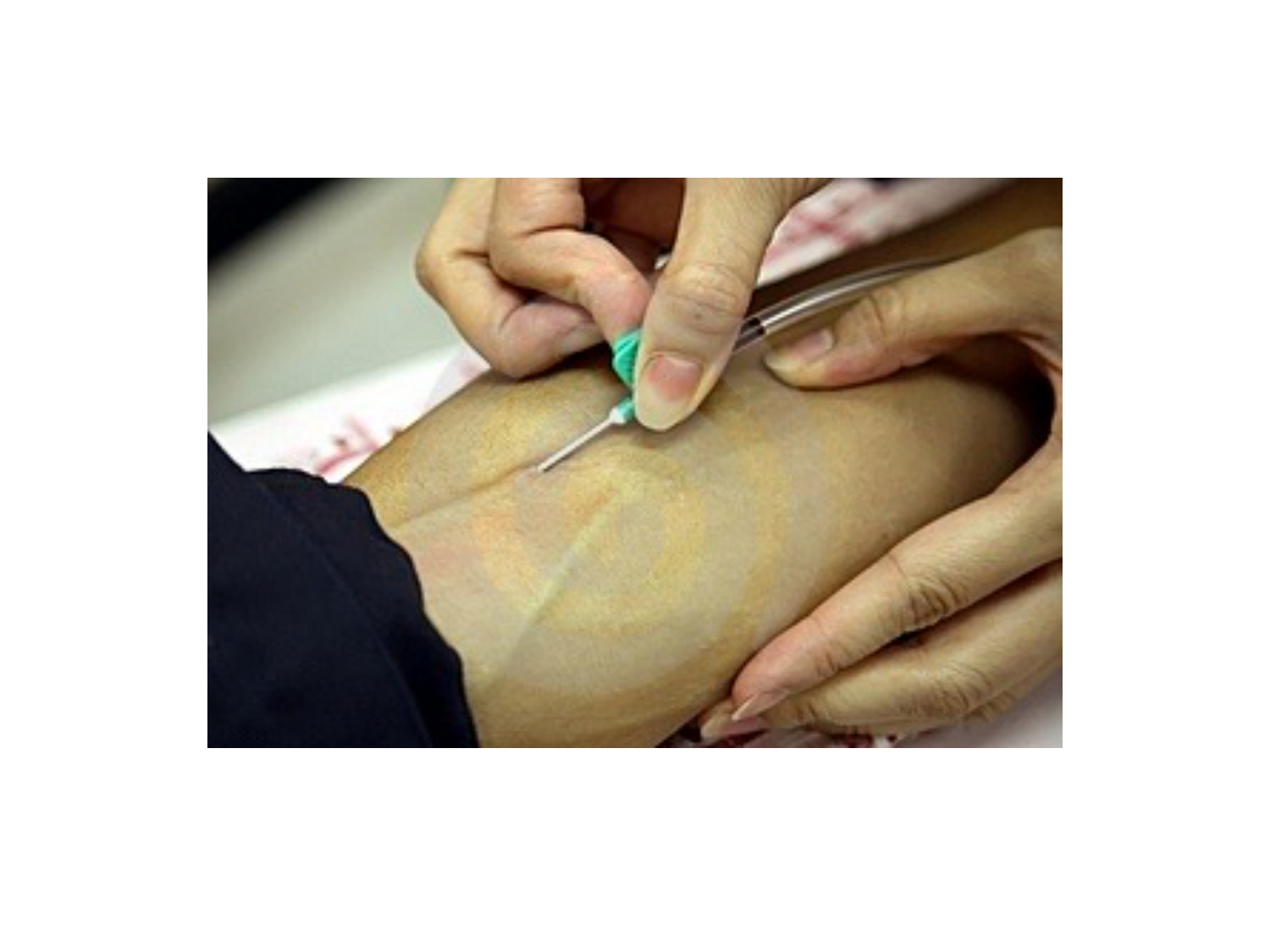 Sang et circulation — introduction page 4