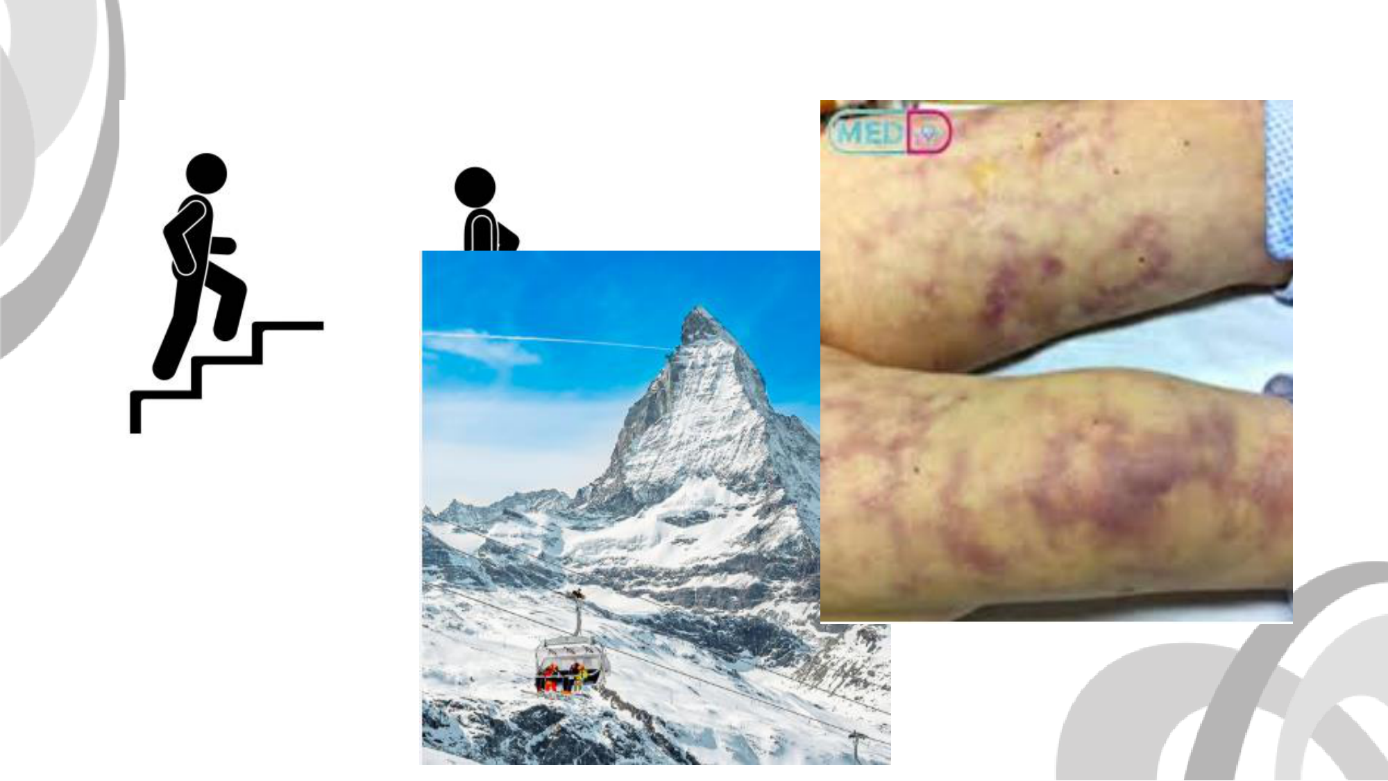 Contrôle ventilatoire page 4