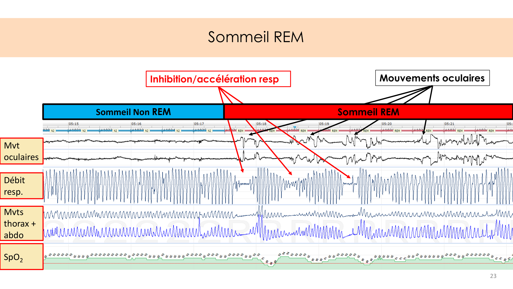 Respiration et sommeil page 23