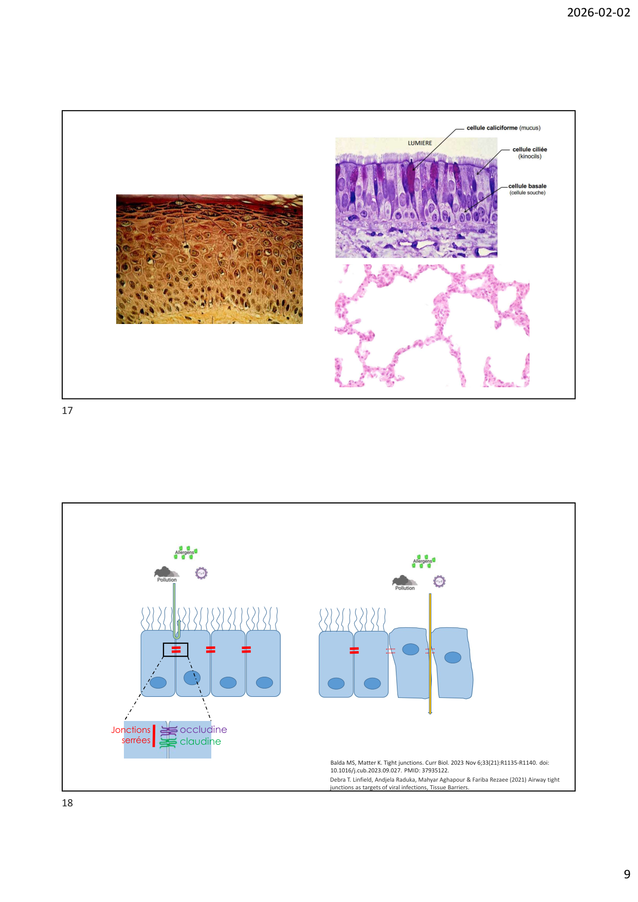 Défense pulmonaire page 9