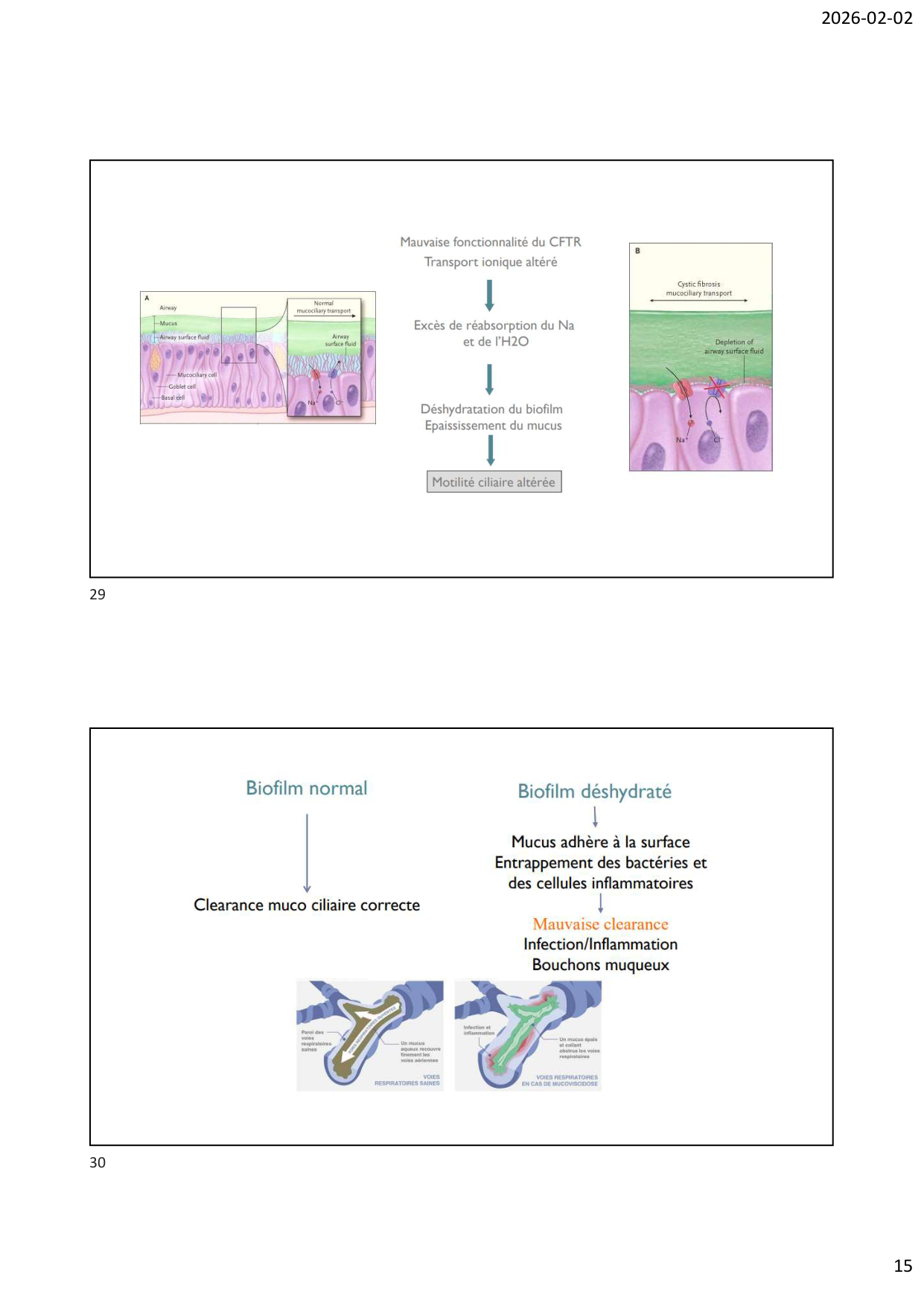 Défense pulmonaire page 15