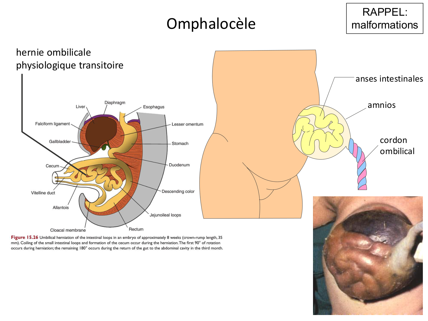 Développement Système Digestif 2025-6 page 32