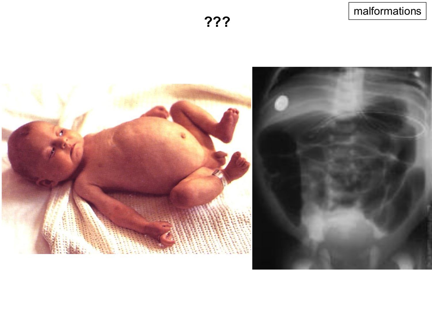 Développement Système Digestif 2025-6 page 51