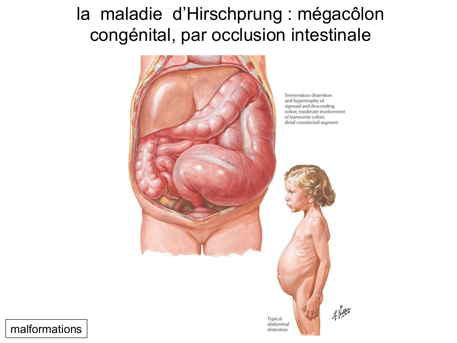 Développement Système Digestif 2025-6 page 52