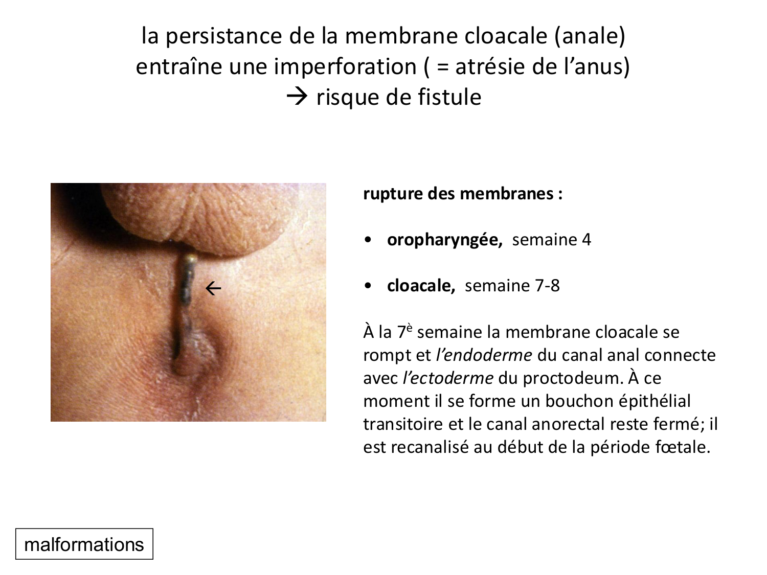 Développement Système Digestif 2025-6 page 86