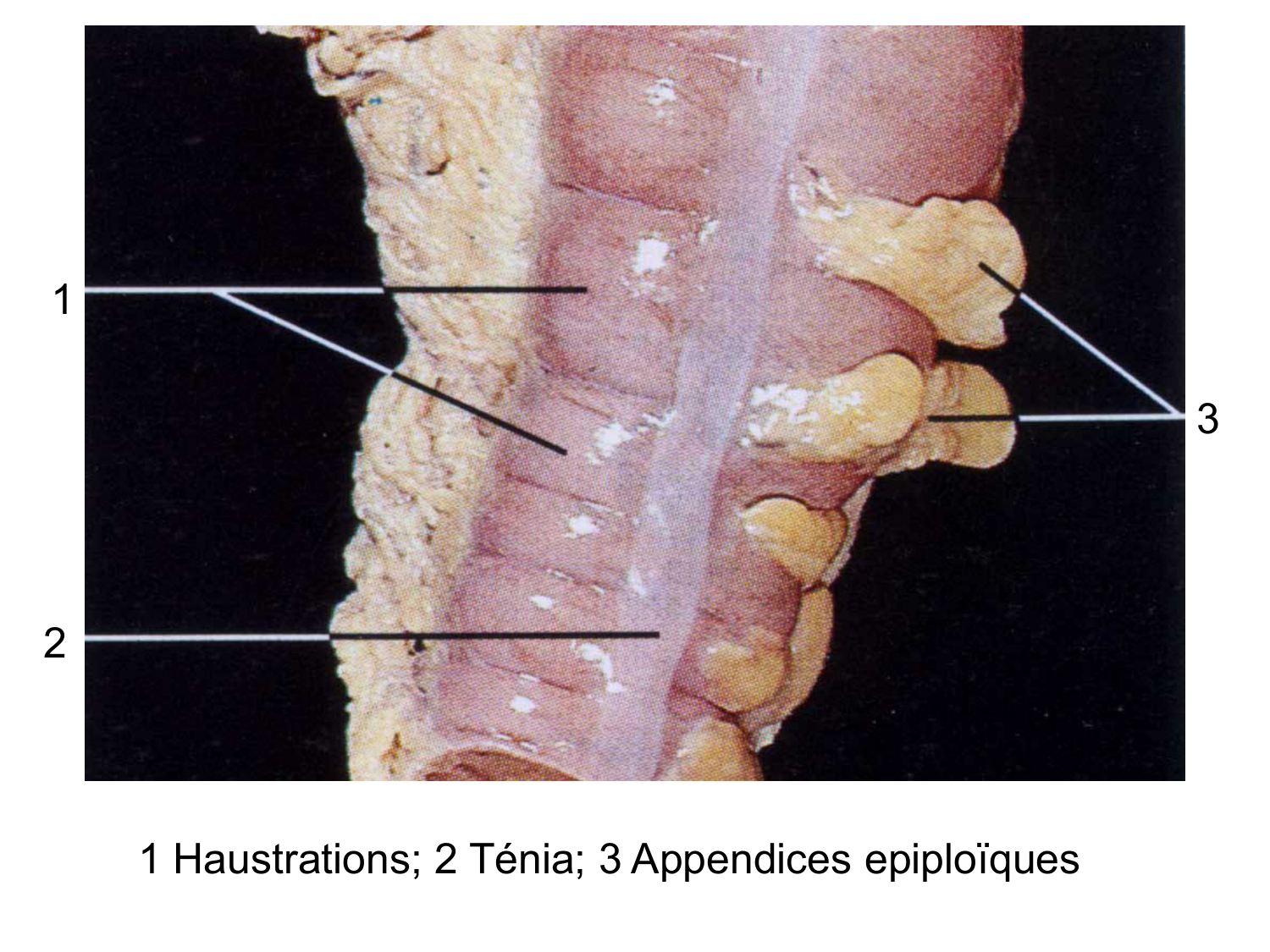 Abdomen gros intestin foie rate pancreas vascularisation page 9
