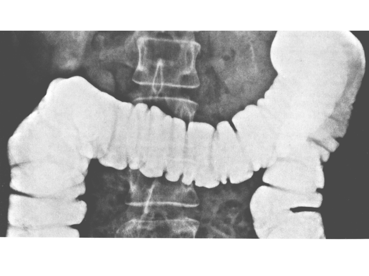 Abdomen gros intestin foie rate pancreas vascularisation page 13
