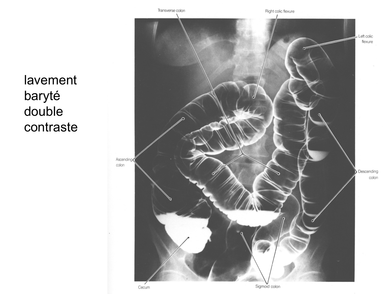 Abdomen gros intestin foie rate pancreas vascularisation page 14