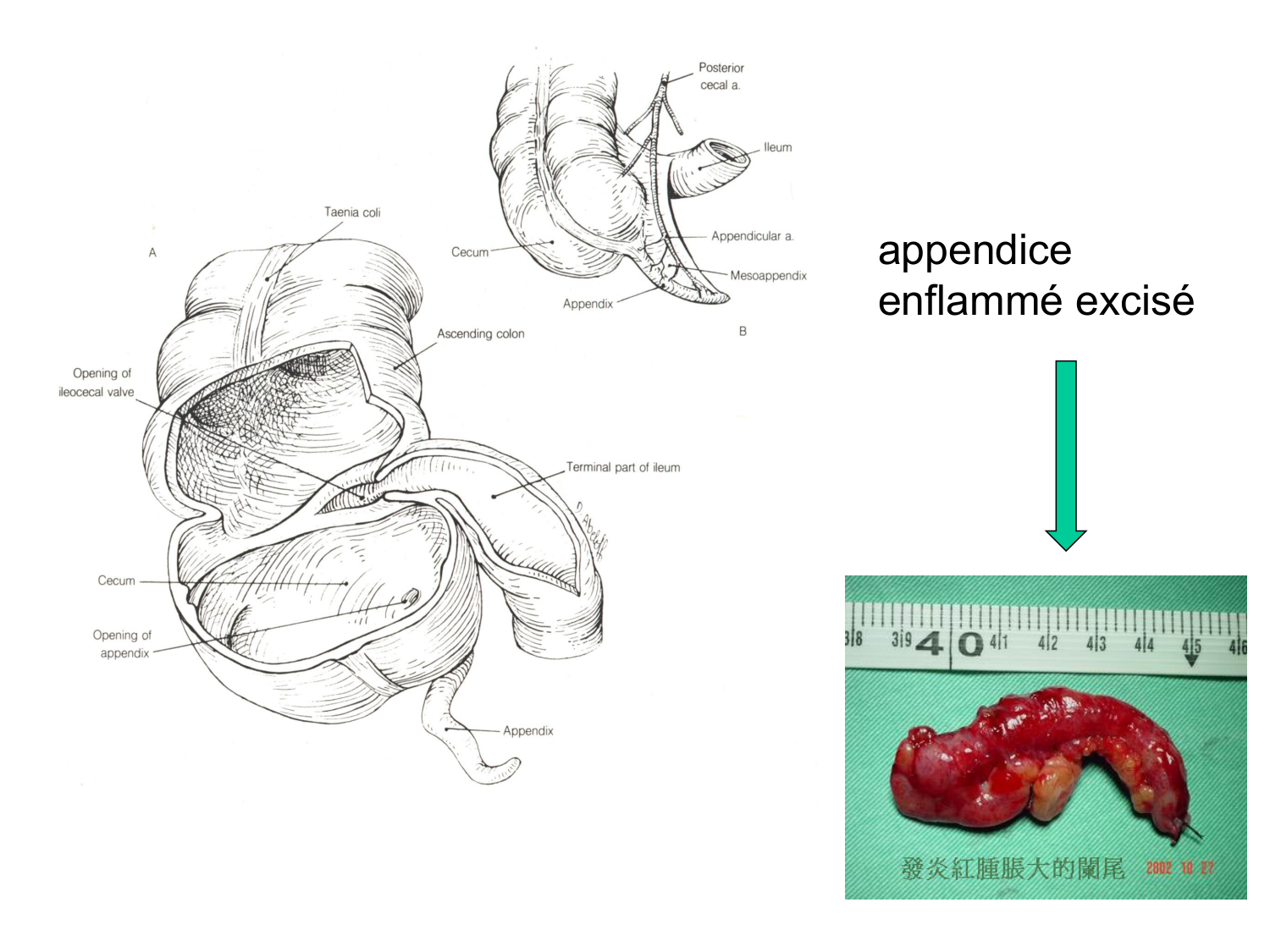 Abdomen gros intestin foie rate pancreas vascularisation page 18