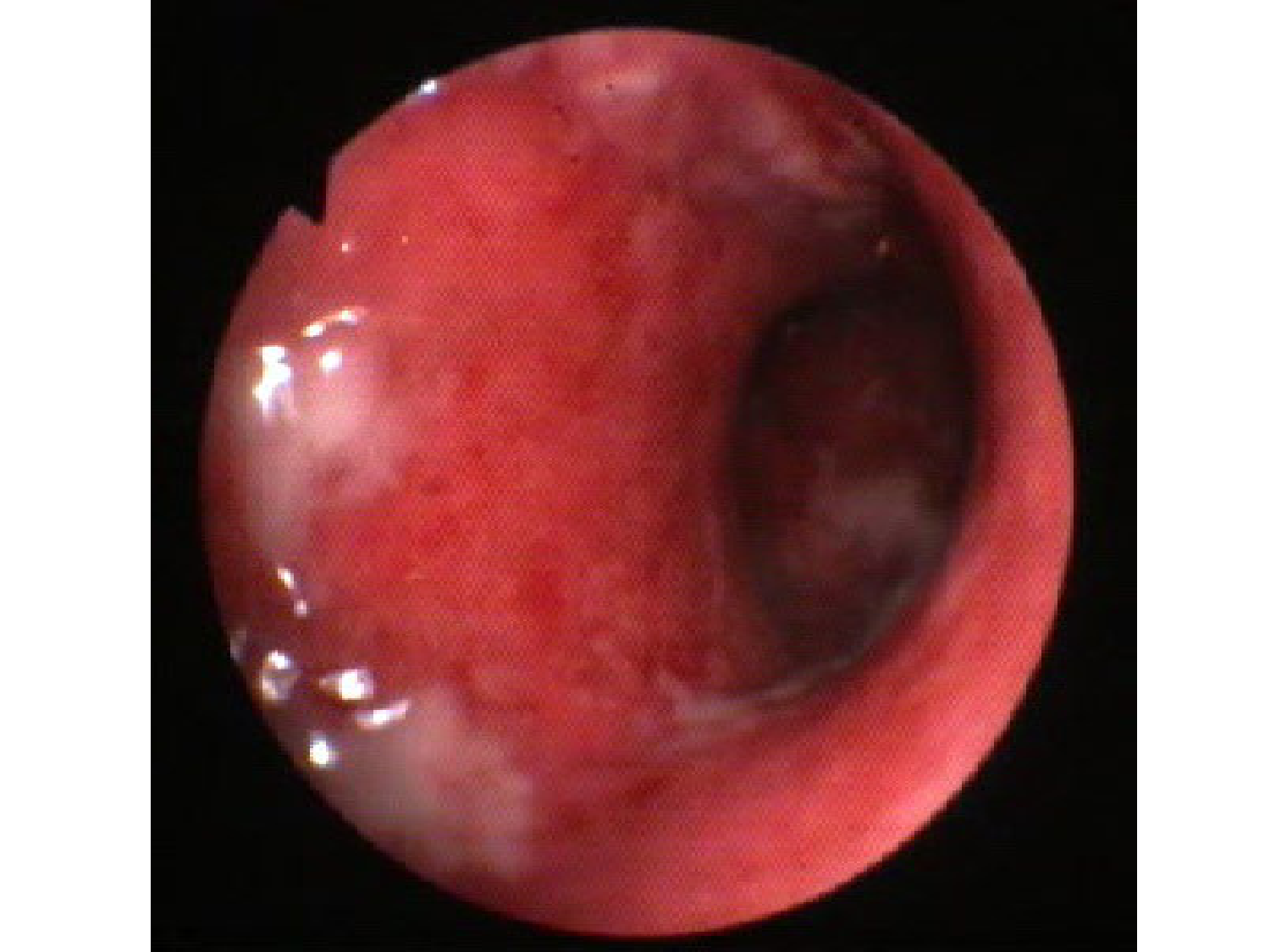 Abdomen gros intestin foie rate pancreas vascularisation page 21