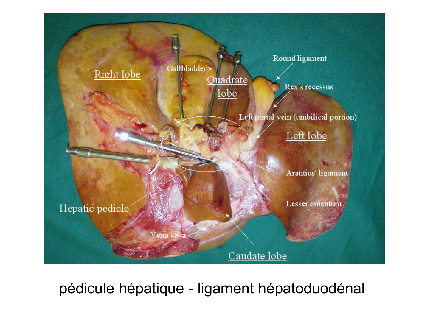 Abdomen gros intestin foie rate pancreas vascularisation page 35