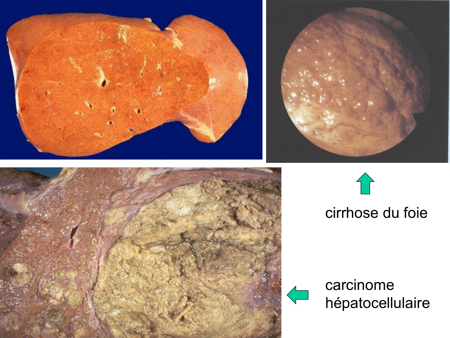 Abdomen gros intestin foie rate pancreas vascularisation page 37