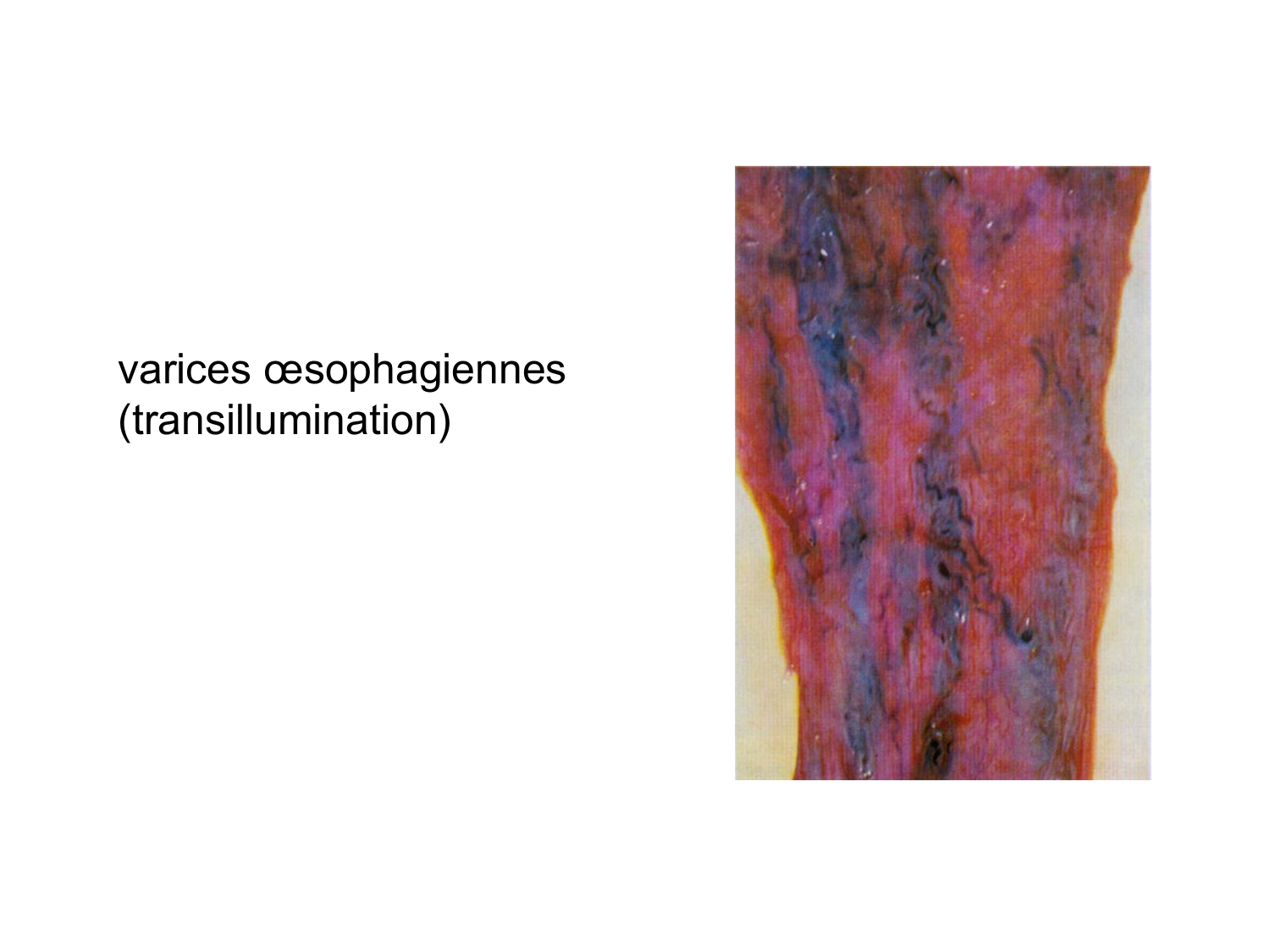 Abdomen gros intestin foie rate pancreas vascularisation page 47