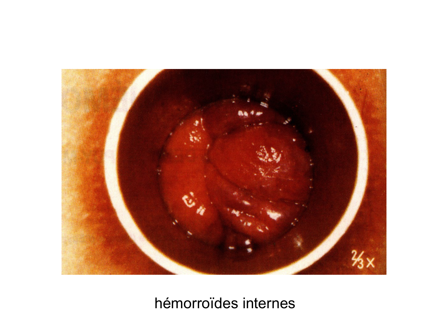 Abdomen gros intestin foie rate pancreas vascularisation page 48