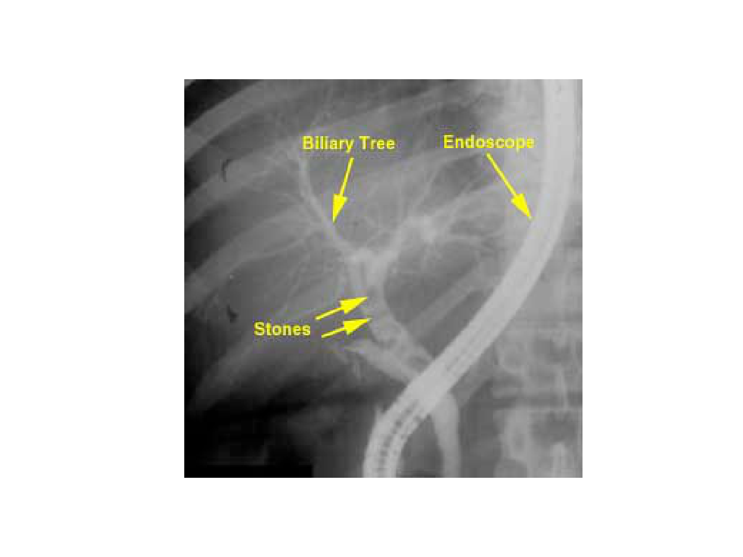 Abdomen gros intestin foie rate pancreas vascularisation page 54