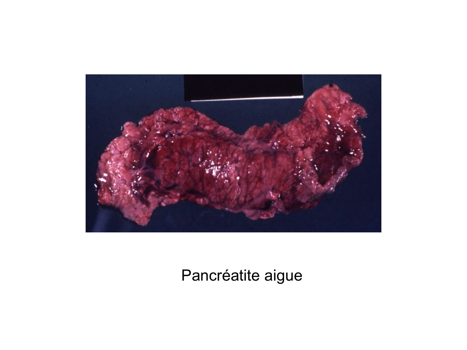 Abdomen gros intestin foie rate pancreas vascularisation page 62