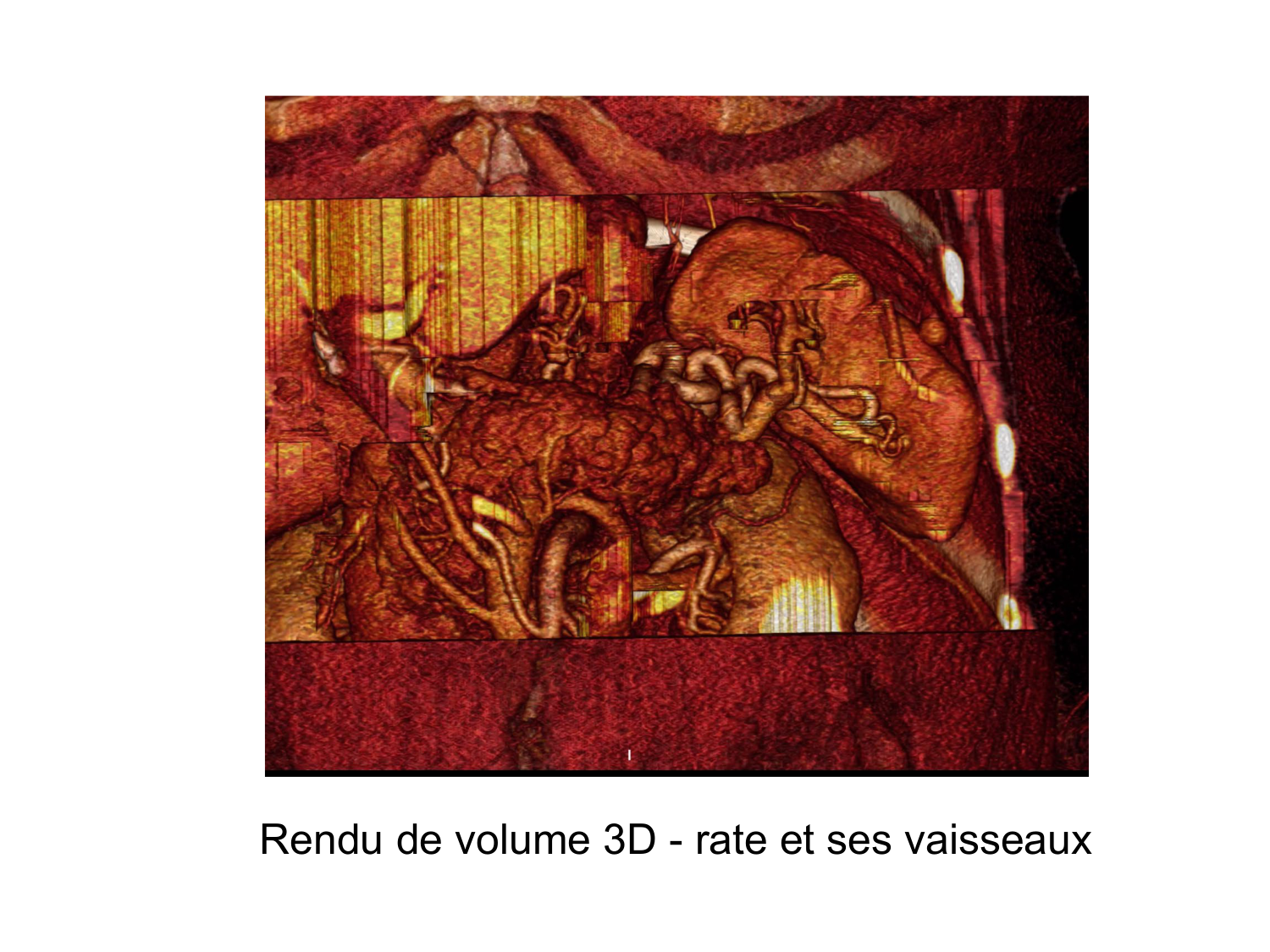 Abdomen gros intestin foie rate pancreas vascularisation page 72