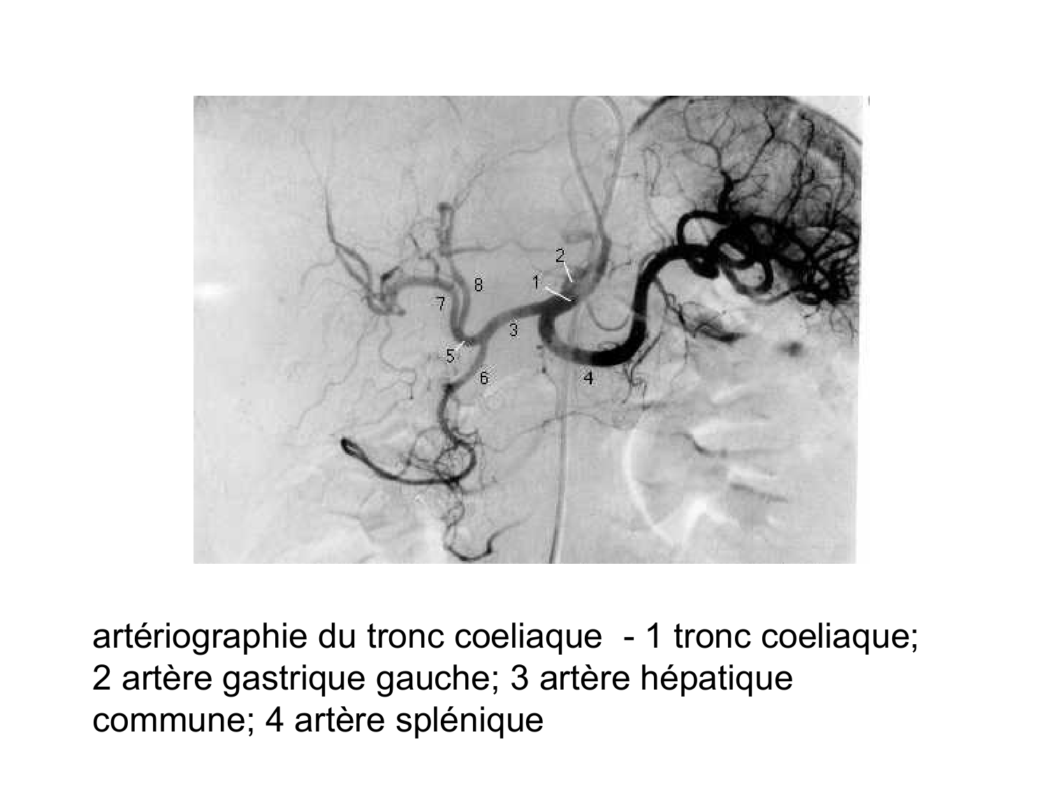Abdomen gros intestin foie rate pancreas vascularisation page 75